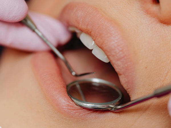 Dental Bridges Treatment Amman