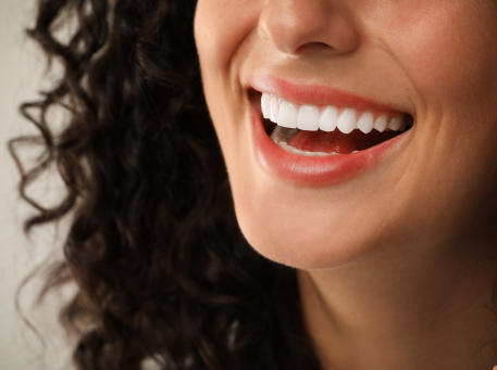 A women Dental Veneer treatment