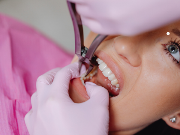 Teeth pain Treatment 3