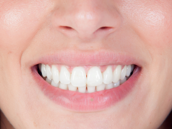 teeth grinding tratment 4