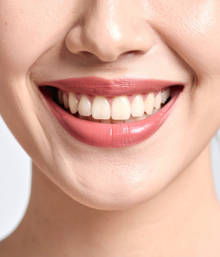 Dental Veneer Treatment 1