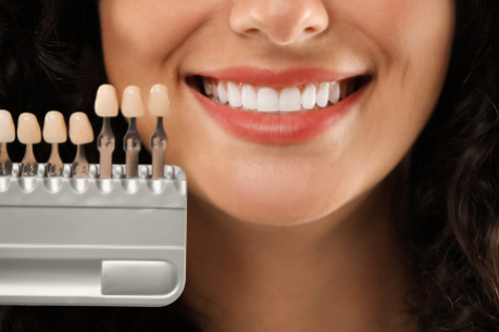 Dental Veneer Treatment